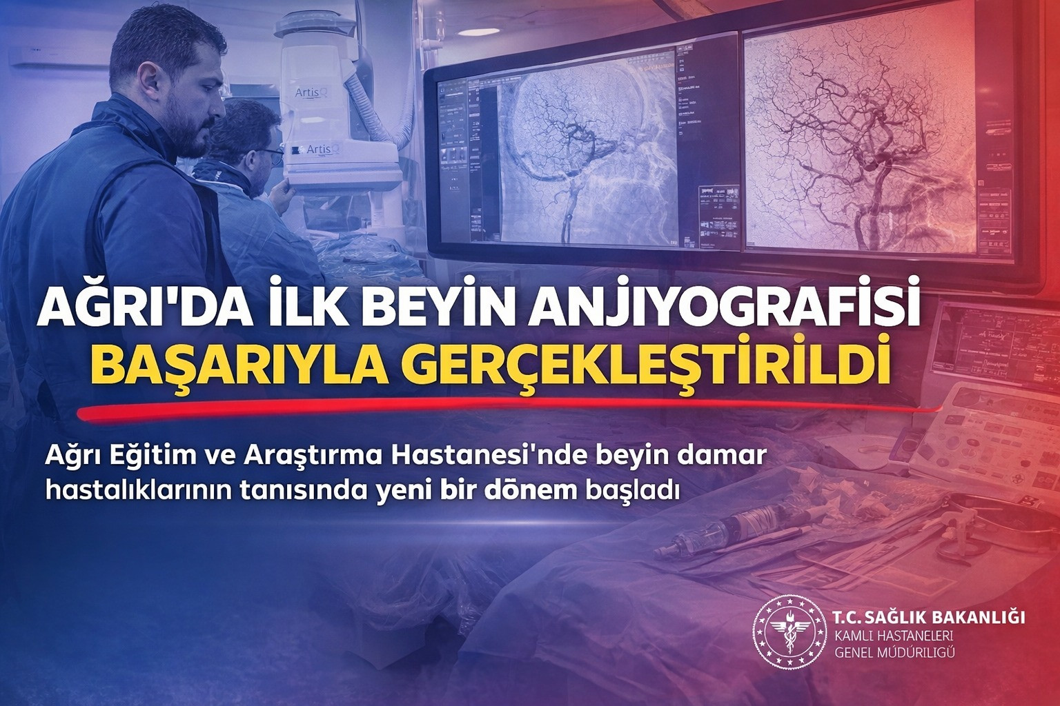 Ağrı’da İlk Beyin Anjiyografisi Başarıyla Gerçekleştirildi